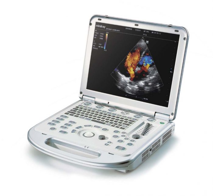 Ultrasound